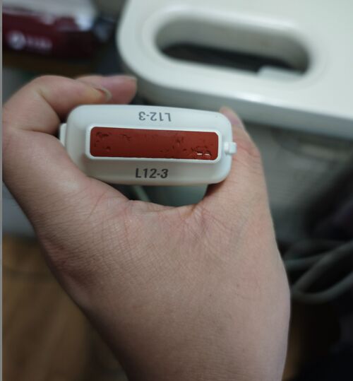 Latest company Solutions about Philips L12-3 Ultrasound Probe Repair