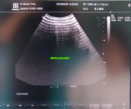 Latest company Solutions about Sonoscape VC6-2 Ultrasound Probe Repair