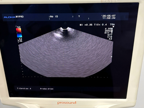 Latest company Solutions about Aloka UST-9124 Ultrasound Probe Repair