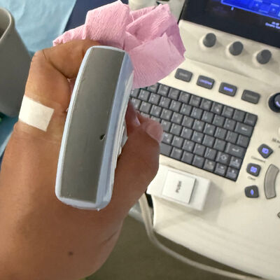 Bom preço Serviço de Reparo de Sonda de Ultrassom GE - Troca da Lente do Transdutor on-line