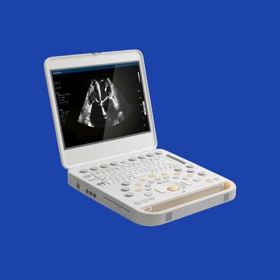 Καλή τιμή Φορητό μηχάνημα υπερήχων Philips CX50 με ρυθμό καρέ 60Hz σε απευθείας σύνδεση